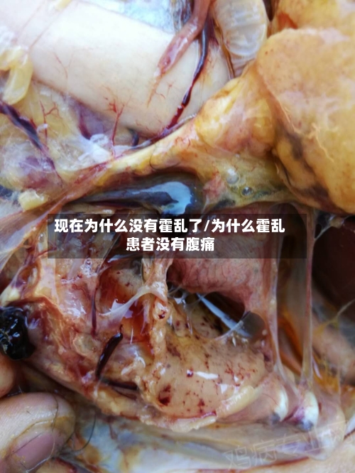 现在为什么没有霍乱了/为什么霍乱患者没有腹痛