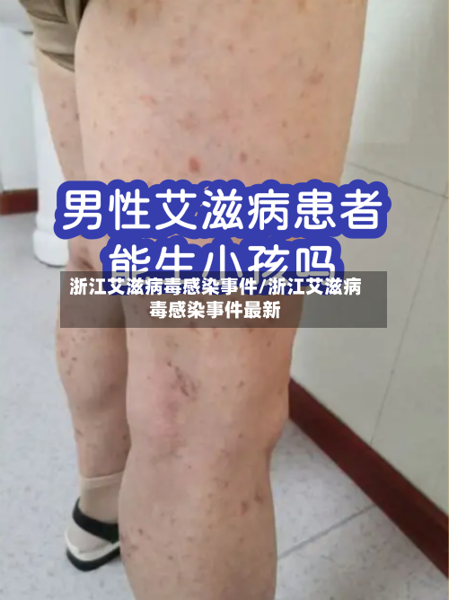 浙江艾滋病毒感染事件/浙江艾滋病毒感染事件最新