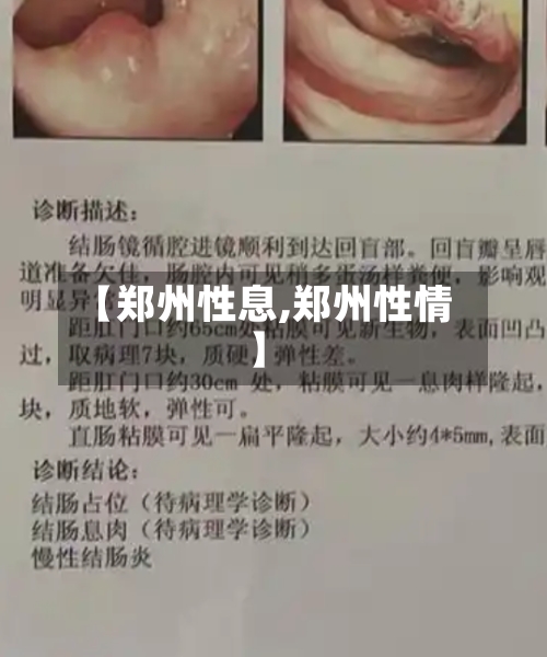 【郑州性息,郑州性情】