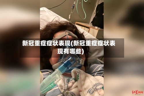 新冠重症症状表现(新冠重症症状表现有哪些)